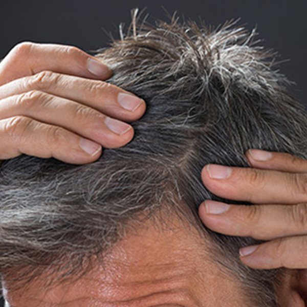 Hair Transplant Surgery Hair Transplant Surgery Treatment in Melbourne