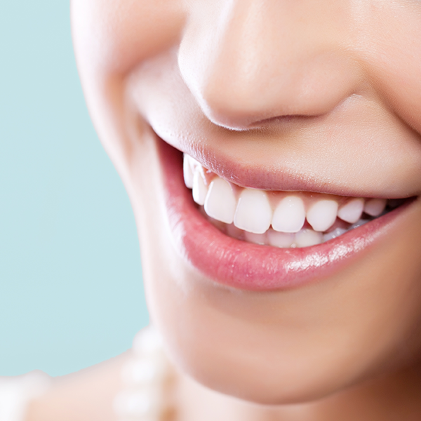 TREATMENTS_TEETH_WHITENING Ultherapy in Melbourne